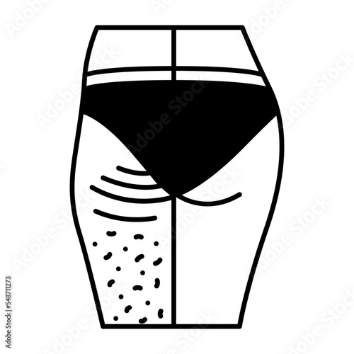 Thigh lift or thighplasty concept, Exfoliation vector icon design, beauty and personal care symbol, cosmetic dermatology sign, body aesthetics stock illustration 