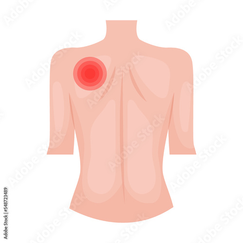 throbbing pain under left shoulder blade, signs of heart problems. Traumas of skin on body part. Vector illustration of open cut wounds with bleeding