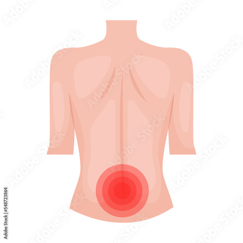 throbbing pain in lower back. Traumas of skin on body part. Vector illustration of open cut wounds with bleeding, fracture and bruise. Cartoon isolated on white