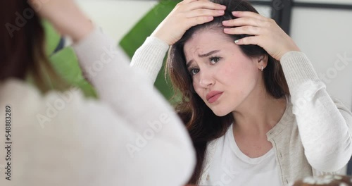 woman have lose hair problem
