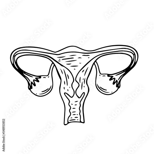 Women health - Floral Infographic of Polycystic ovary syndrome. Patient-friendly scheme of PCOS, Multifollicular cyst. Gynecological problems - Neutral medical diagram uterus and uterine appendages