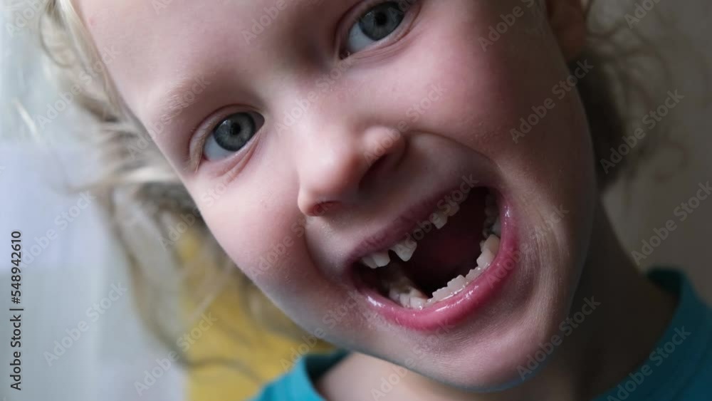 Little blond girl touching and showing milk tooth Little blond girl touching and showing milk tooth