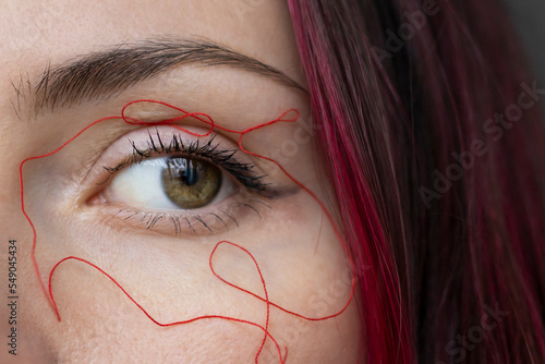 The concept of couperose and spider veins around a woman's eyes. Facial skin care. photo