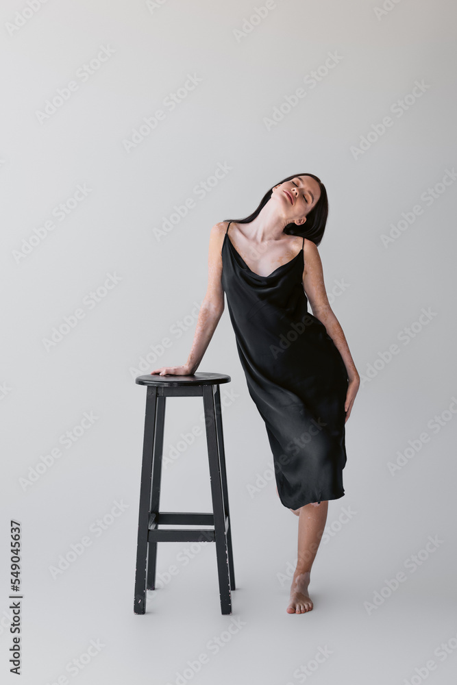 Sensual woman with vitiligo in silk dress touching chair on grey background. Sensual woman with vitiligo in silk dress touching chair on grey background.