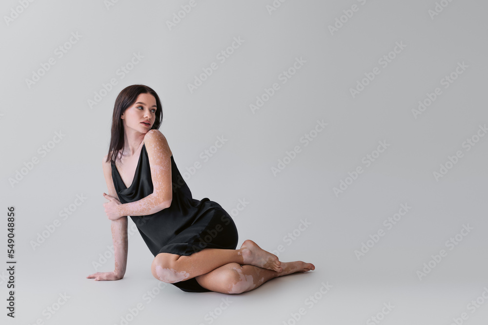 Sensual woman with vitiligo posing in dress while sitting on grey background.