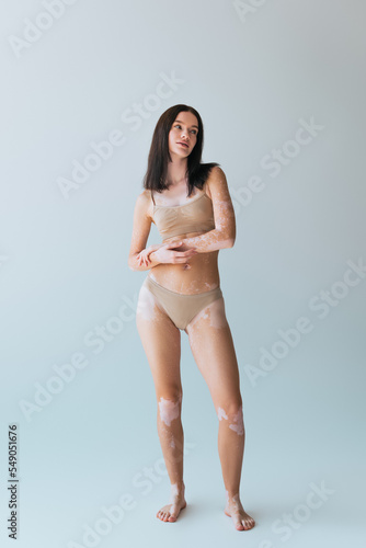 full length of brunette young woman with vitiligo posing in beige lingerie while looking away on grey.