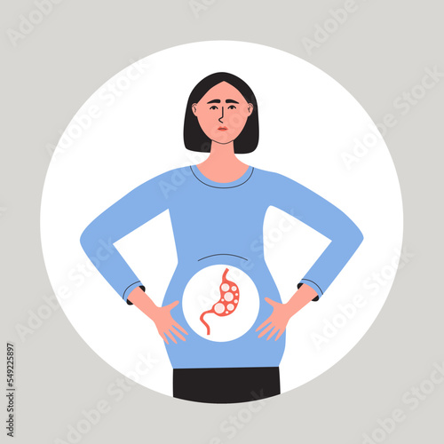 Young woman suffering fom abdominal bloating. Female with flatulence. Gastroenterology disease concept. Fat vector medical illustration