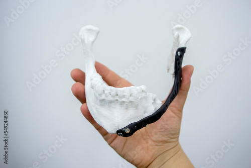 Slika na platnu Person holding in hand 3D printed plastic prototype human lower jaw and medical titanium implant close-up