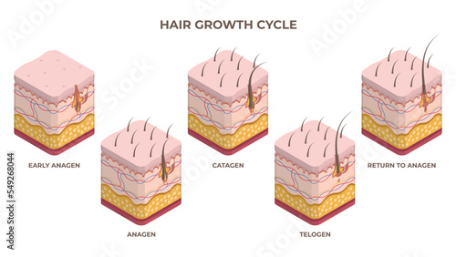 Isometric hair growth cycle, anagen, telogen, catagen phases. Human skin layers with hair follicle growth flat vector illustration set. Hair growth stages