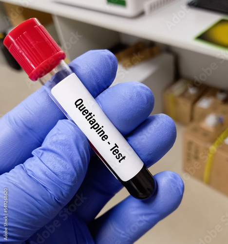 Laboratory test for Quetiapine level, It's an antipsychotic drug indicated for the treatment of schizophrenia and bipolar disorder. Quetiapine test to set a therapeutic range. photo