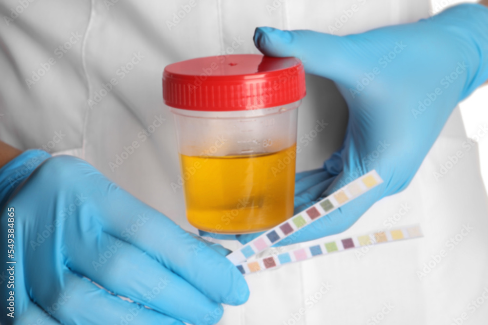 Nurse holding test strips and container with urine sample for analysis, closeup Nurse holding test strips and container with urine sample for analysis, closeup
