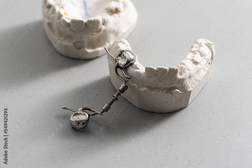 Plaster models of dental prostheses. Demonstration models of dentures
