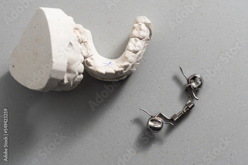 Dental casting gypsum model of human jaws. Crooked teeth and distal bite. Shots were made before treatment with braces . Technical shots on gray background. photo
