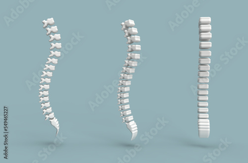 3D Realistic human spine backbone and vertebral column anatomy scoliosis concept