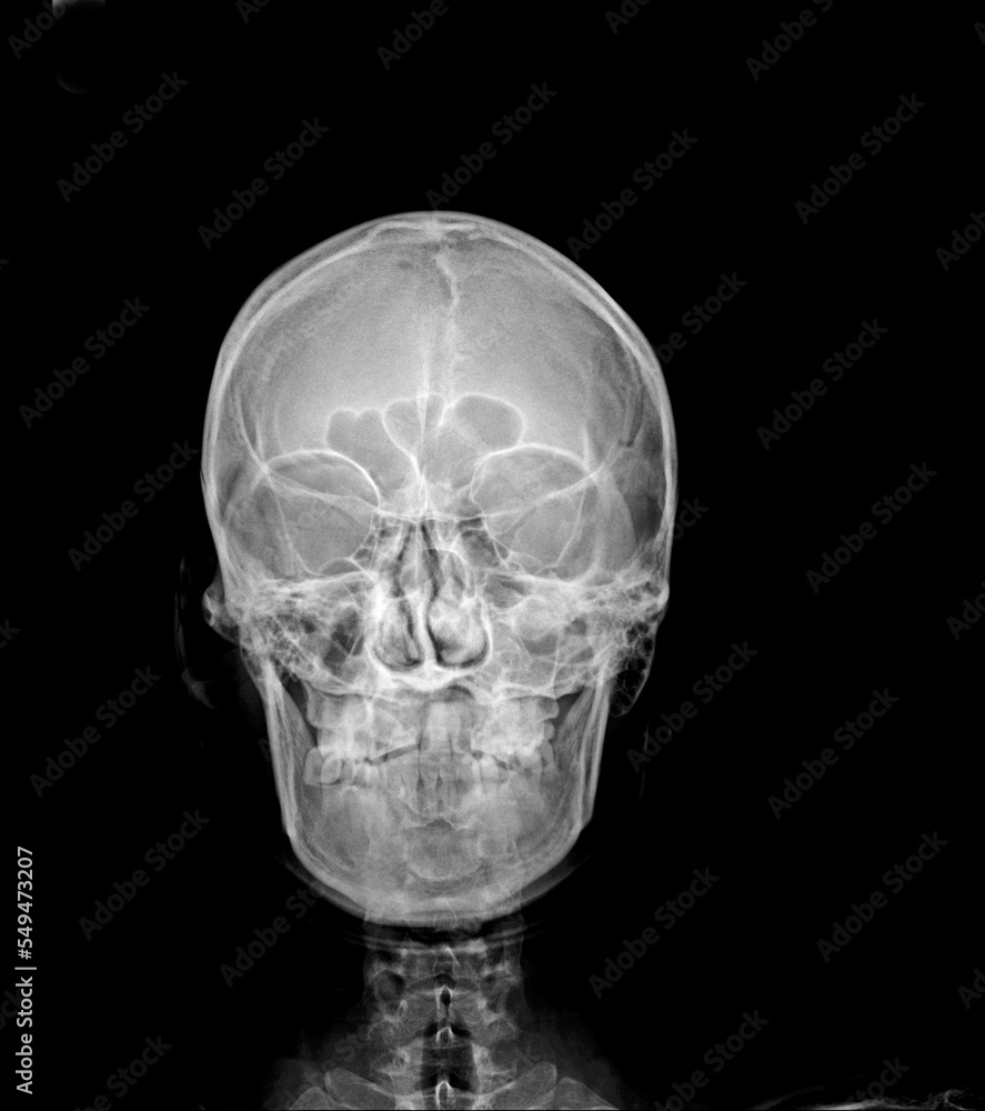 human skull ray human skull ray