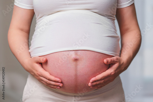 Dark stripe on the belly of a pregnant woman, home living room © Андрей Журавлев