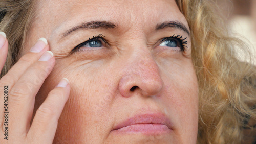 middle aged female's eye with drooping eyelid with patch for eyes. Ptosis is a drooping of the upper eyelid, lazy eye. Cosmetology and facial concept, first wrinkles photo
