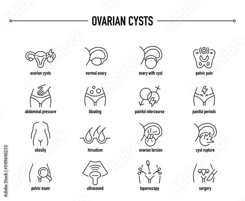 Ovarian Cysts symptoms, diagnostic and treatment vector icon set. Line editable medical icons.