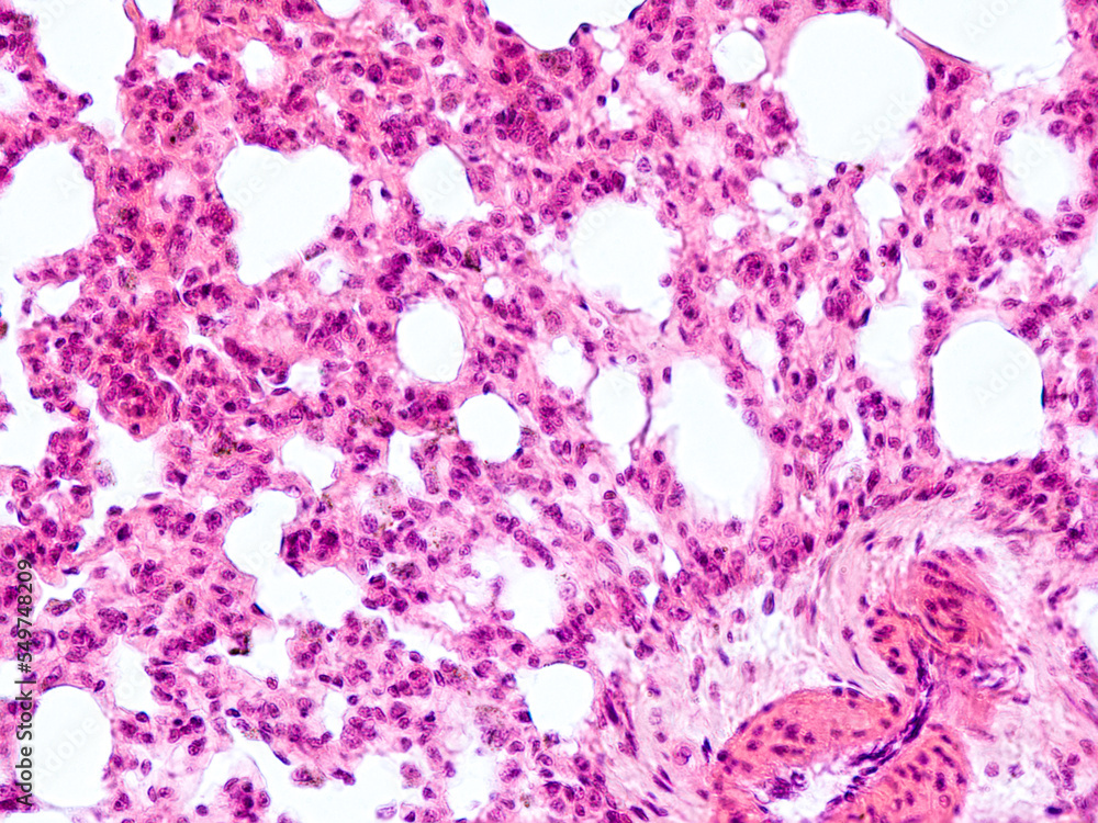 guinea pig lung transverse section under the microscope optical