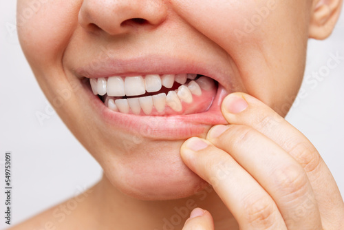 Gum health. Cropped shot of a young woman showing healthy gums with her hand isolated on a white background. Dentistry, dental care 