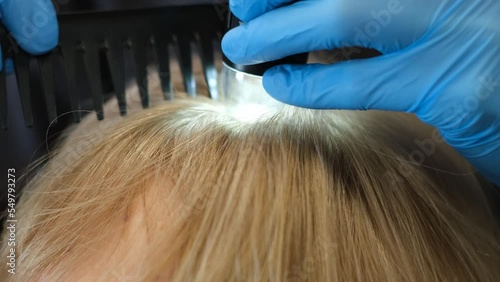 Doctor diagnoses the structure of the hair. Consultation with a trichologist. photo