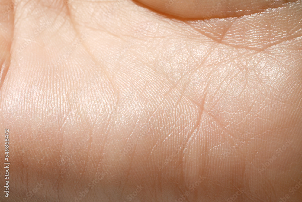 Fototapeta premium Closeup view of human hand with dry skin