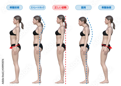 女性の正しい姿勢と悪い姿勢の比較イラスト（猫背・ストレートネック・骨盤前傾後傾）