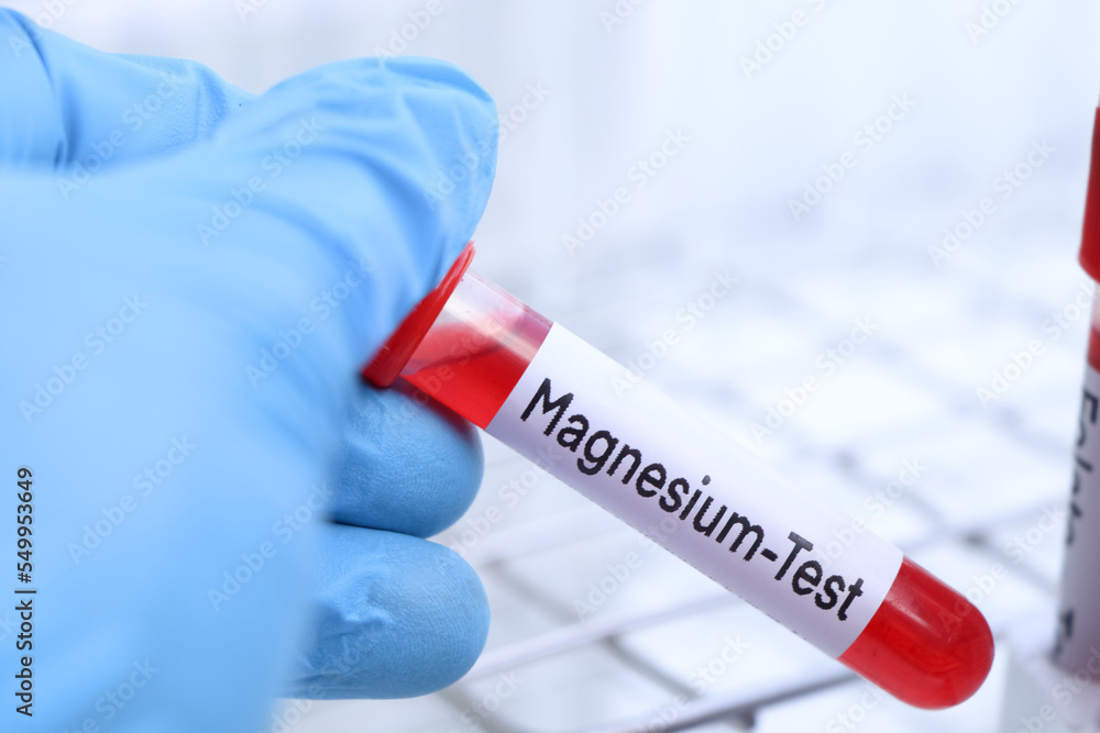 Magnesium test to look for abnormalities from blood Stock Photo | Adobe ...
