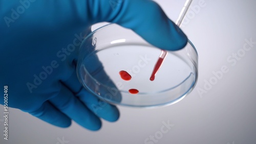 Microbiologist or medical holding blood samples and pipette on hospital photo