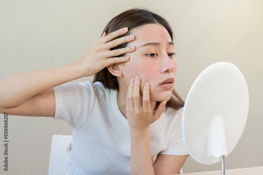 Dermatology, scratch asian young woman looking at mirror, expression worry and itch, itchy allergy or allergic sensitive reaction, red spot or rash on her face. Beauty care from skin problem treatment Dermatology, scratch asian young woman looking at mirror, expression worry and itch, itchy allergy or allergic sensitive reaction, red spot or rash on her face. Beauty care from skin problem treatment