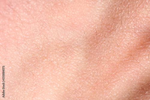 background of a pink skin texture. Healthy skin. Macro photo of skin cells. photo