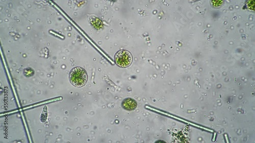 Close-up the smooth movement of camera for panning various bacteria in laboratory under microscope. Microbes move quickly with tendrils in special liquid. Research scientists a unicellular organisms.