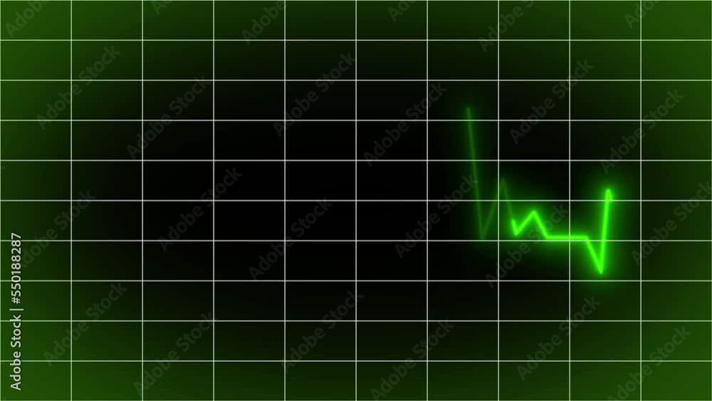 Animation of a cardiograph showing a pulse or heart beat Animation of a cardiograph showing a pulse or heart beat