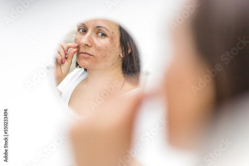 Photo of woman having skin problems looking in the mirror. photo