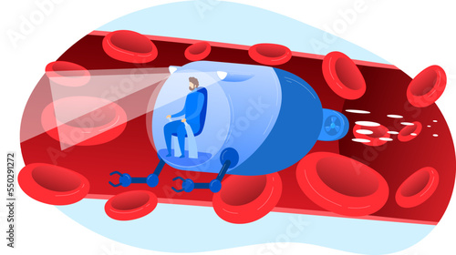 Blood vessel health care by micro nano technology, cancer disease analysis, vector illustration. Tiny man in nanotechnology transport model
