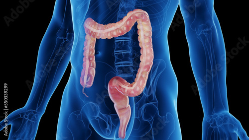 3d rendered medical illustration of a man's large intestine