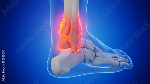 3d rendered medical illustration of a man's ankle