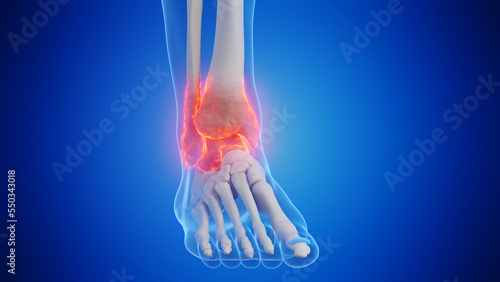 3d rendered medical illustration of a man's ankle