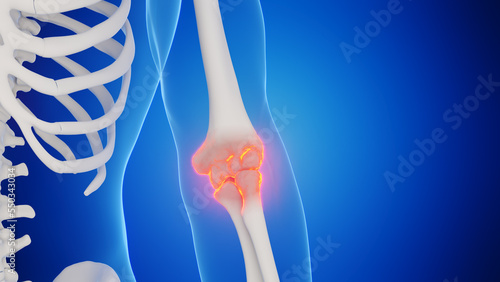 3d rendered medical illustration of a man's elbow joint photo
