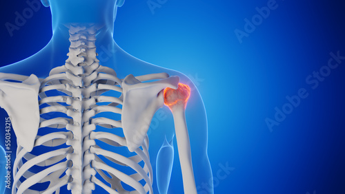 3d rendered medical illustration of a man's shoulder joint photo