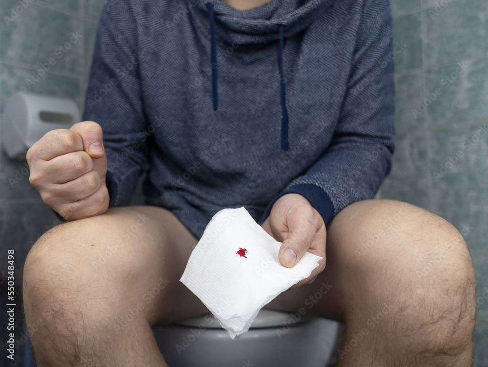 Hemorrhoid concept. A man sits on the toilet and holds white toilet