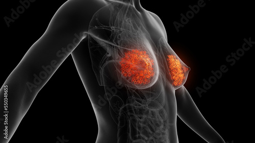 3d rendered medical illustration of mammary glands photo