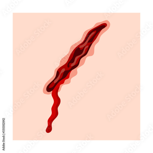 Skin scar with stitches cartoon illustration. Bloody wound, injures, scratches, bruises, surgical sutures on legs or arms on skin background