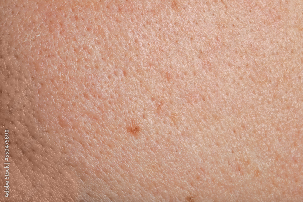 Closeup view of human skin as background