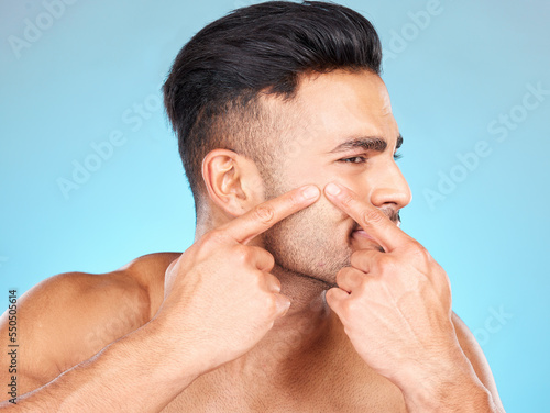 Man, hands and pop acne of face for skincare, beauty wellness or skin dermatology. Indian man, upset and press facial pimples or blackhead in blue background studio for morning cosmetics care