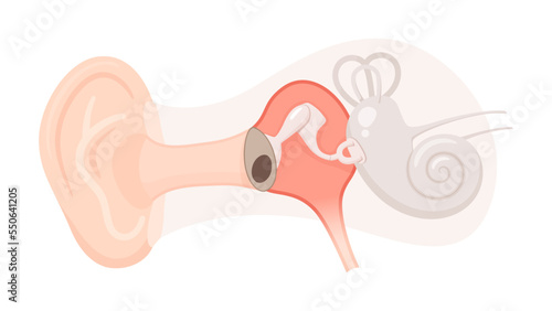 耳の構造のイラスト_慢性中耳炎_鼓膜穿孔