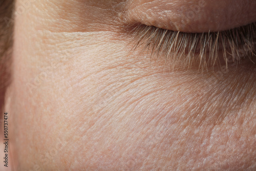 Closeup view of woman with normal skin photo