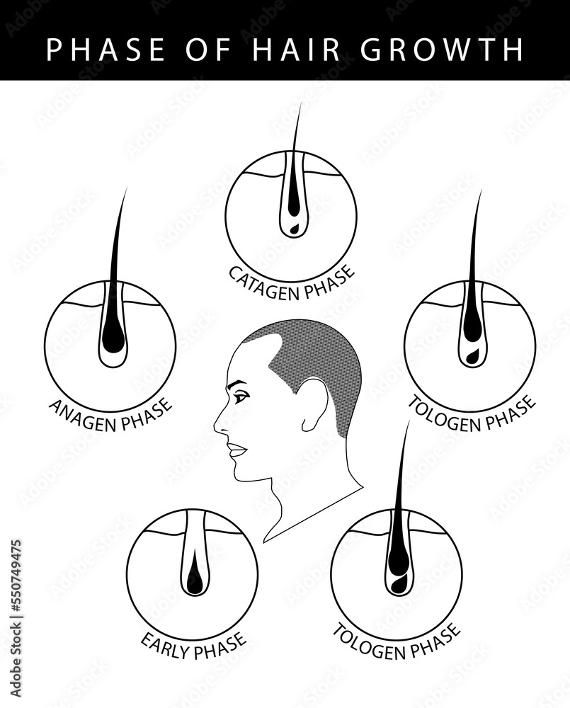Phase of human hair growth cycle catagen, telogen, early, anagen phase