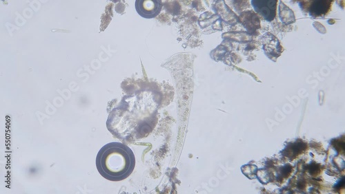 Different freshwater  species of protozoa single cell organisms as stentors, ciliates and algae movement under microscope bright filed view photo