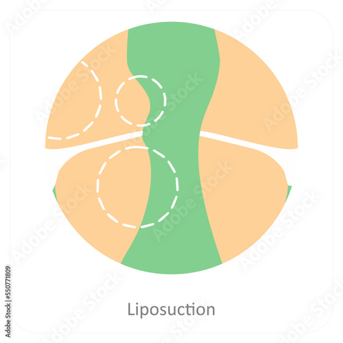 Liposuction